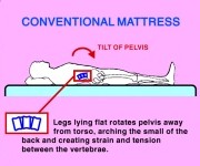 Conventional Mattress Back aches